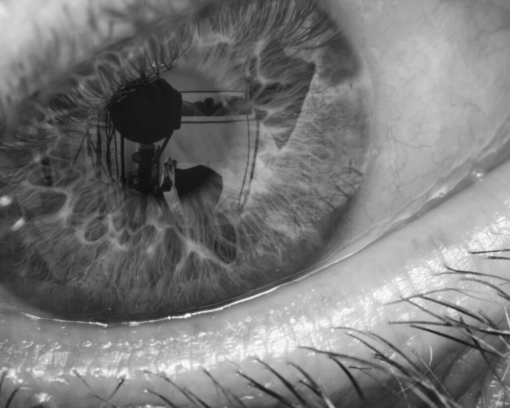 Part of the eye, iris