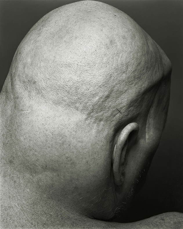 Photograph of Nixon showing a bald man's skull